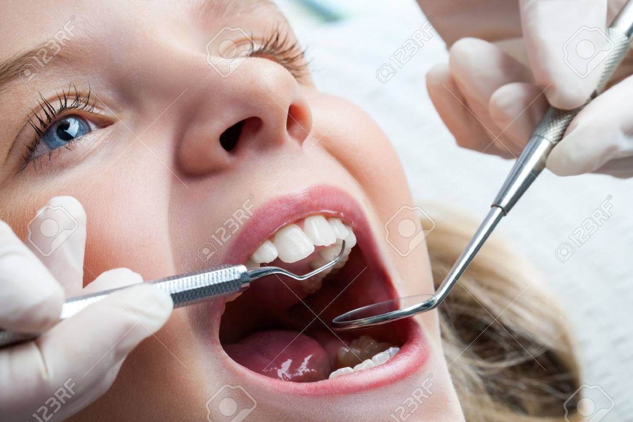 32793608-macro-close-up-of-young-child-with-open-mouth-at-dentist-